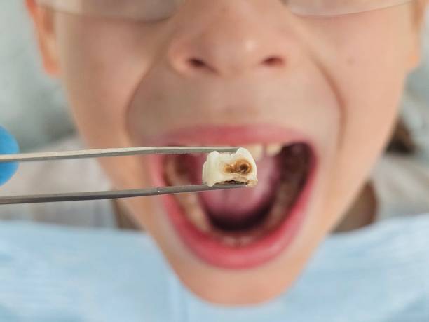 Best Knocked-Out Tooth Emergency  in Clarence Center, NY